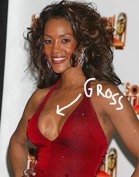 Vivica Fox Autors: Khalifa 12 Sliktākās plastiskās operācijas
