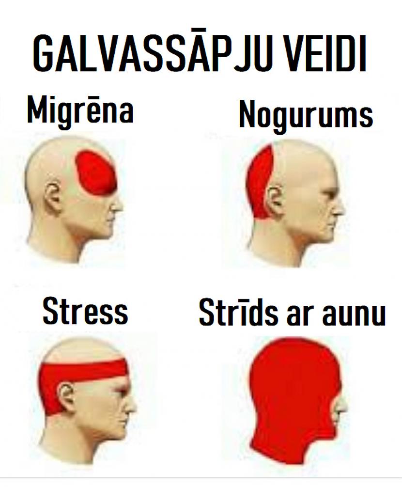 Autors: The Diāna Memes par AUNIEM