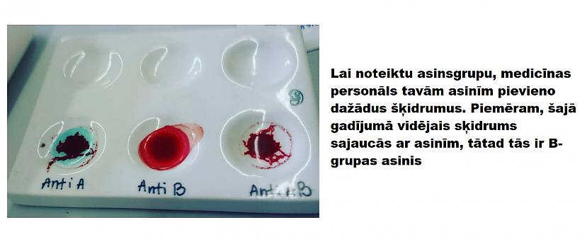 Autors: The Diāna 15 izglītojoši attēli par cilvēka ķermeni