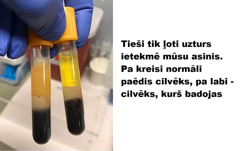 Autors: The Diāna 15 izglītojoši attēli par cilvēka ķermeni