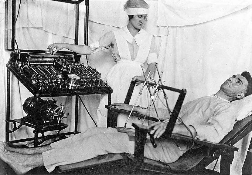 Elektroscaronoka... Autors: Artemiis Ļoti DĪVAINAS ārstniecības metodes vēsturē